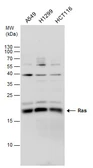 Anti-RAS antibody used in Western Blot (WB). GTX132480