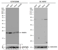 Anti-RAB7A antibody used in Western Blot (WB). GTX132548