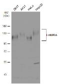 Anti-LAMP2A antibody used in Western Blot (WB). GTX132655