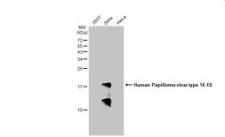 Anti-Human Papilloma virus type 16 E6 antibody used in Western Blot (WB). GTX132686