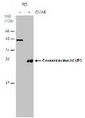 Anti-Coxsackievirus A6 VP3 antibody used in Western Blot (WB). GTX132688