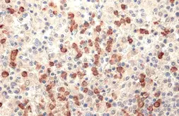 Anti-Lipocalin-2 antibody used in IHC (Paraffin sections) (IHC-P). GTX132773