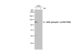 Anti-JAK2 (phospho Tyr1007/1008) antibody used in Western Blot (WB). GTX132784