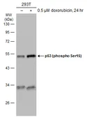 Anti-p53 (phospho Ser46) antibody used in Western Blot (WB). GTX132996