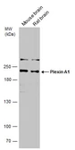 Anti-Plexin A1 antibody used in Western Blot (WB). GTX133240