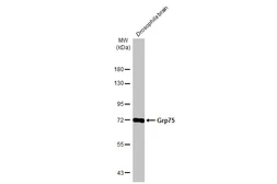 Anti-Grp75 antibody used in Western Blot (WB). GTX133283