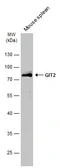 Anti-GIT2 antibody used in Western Blot (WB). GTX133285