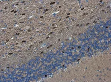 Anti-PEX5L antibody used in IHC (Paraffin sections) (IHC-P). GTX133287