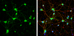 Anti-mGluR5 antibody used in Immunocytochemistry/ Immunofluorescence (ICC/IF). GTX133288