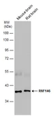 Anti-RNF146 antibody used in Western Blot (WB). GTX133293