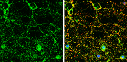 Anti-CADM4 antibody used in Immunocytochemistry/ Immunofluorescence (ICC/IF). GTX133294