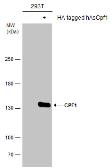 Anti-CPF1 antibody used in Western Blot (WB). GTX133296