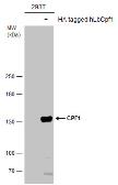 Anti-CPF1 antibody used in Western Blot (WB). GTX133299