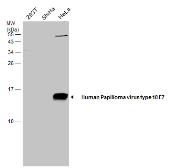 Anti-Human Papilloma virus type 18 E7 antibody used in Western Blot (WB). GTX133412