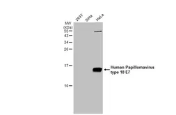 Anti-Human Papillomavirus type 18 E7 antibody used in Western Blot (WB). GTX133412