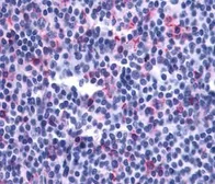 Anti-Leukotriene B4 Receptor 2 antibody used in IHC (Paraffin sections) (IHC-P). GTX13348