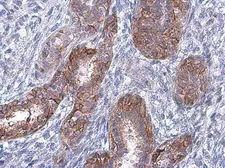 Anti-EGFR (phospho Tyr974) antibody used in IHC (Paraffin sections) (IHC-P). GTX133601