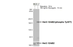 Anti-Her2 / ErbB2 (phospho Tyr877) antibody used in Western Blot (WB). GTX133605