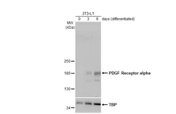 Anti-PDGF Receptor alpha antibody used in Western Blot (WB). GTX133619