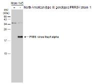 Anti-PRRS virus Nsp1 alpha antibody used in Western Blot (WB). GTX133695