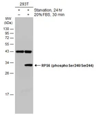 Anti-RPS6 (phospho Ser240/Ser244) antibody used in Western Blot (WB). GTX133942