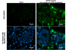 Anti-Ebola virus VP35 antibody used in Immunocytochemistry/ Immunofluorescence (ICC/IF). GTX134032