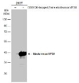 Anti-Ebola virus VP30 antibody used in Western Blot (WB). GTX134035