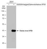Anti-Ebola virus VP30 antibody used in Western Blot (WB). GTX134036
