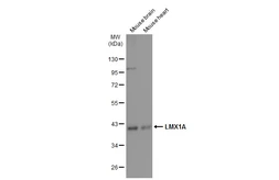 Anti-LMX1A antibody used in Western Blot (WB). GTX134047