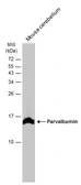 Anti-Parvalbumin antibody used in Western Blot (WB). GTX134127