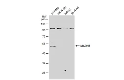 Anti-SMAD7 antibody used in Western Blot (WB). GTX134260