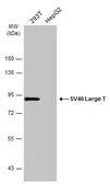 Anti-SV40 Large T-antigen antibody used in Western Blot (WB). GTX134377