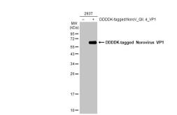 Anti-Norovirus VP1 antibody used in Western Blot (WB). GTX134380