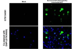 Anti-Norovirus VP1 antibody used in IHC-P (cell pellet) (IHC-P (cell pellet)). GTX134381