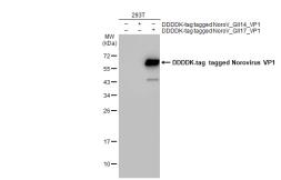 Anti-Norovirus VP1 antibody used in Western Blot (WB). GTX134382
