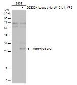 Anti-Norovirus VP2 antibody used in Western Blot (WB). GTX134383