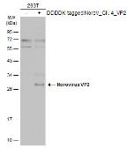 Anti-Norovirus VP2 antibody used in Western Blot (WB). GTX134383
