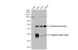Anti-Clusterin alpha antibody used in Western Blot (WB). GTX134435