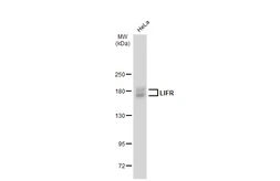Anti-LIFR antibody used in Western Blot (WB). GTX134466