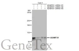 Anti-ADAMTS1 antibody used in Western Blot (WB). GTX134840
