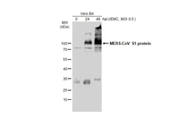 Anti-MERS-CoV Spike (S1) antibody used in Western Blot (WB). GTX134864