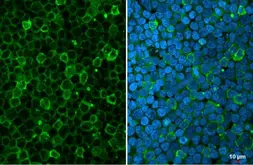 Anti-Myeloperoxidase antibody used in Immunocytochemistry/ Immunofluorescence (ICC/IF). GTX135126