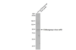 Anti-Chikungunya virus nsP2 antibody used in Western Blot (WB). GTX135188