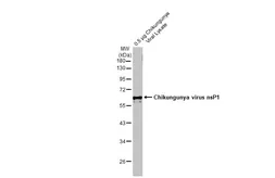 Anti-Chikungunya virus nsP1 antibody used in Western Blot (WB). GTX135191