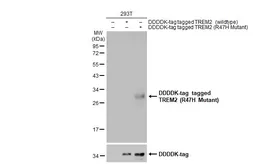Anti-TREM2 (R47H Mutant) antibody used in Western Blot (WB). GTX135408