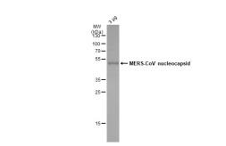 MERS-CoV Nucleocapsid protein, DDDDK tag. GTX135653-pro