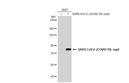 Anti-SARS-CoV-2 (COVID-19) nsp2 antibody used in Western Blot (WB). GTX135717
