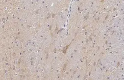 Anti-Tau (phospho Thr217) antibody used in IHC (Paraffin sections) (IHC-P). GTX135775