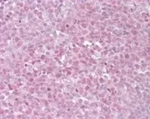 Anti-TRF2 antibody used in IHC (Paraffin sections) (IHC-P). GTX13589