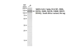 SARS-CoV-2 (COVID-19) Spike S1 Protein, B.1.351 / Beta variant, His tag (active). GTX136095-pro